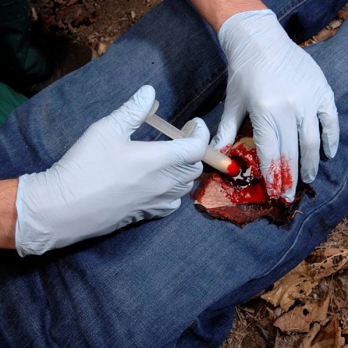 Аппликатор гемостатический с гранулами Rhino Rescue в Красноярске хитозановый